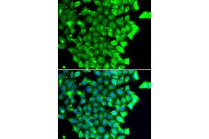 Immunofluorescence analysis of MCF-7 cells using TRIAP1 antibody (ABIN4905489). (TRIAP1 Antikörper)
