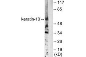 Western blot analysis of extracts from HeLa cells, using Keratin 10 Antibody. (Keratin 10 Antikörper  (AA 136-185))