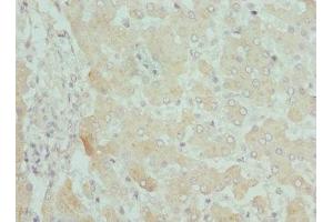 Immunohistochemistry of paraffin-embedded human liver tissue using ABIN7146778 at dilution of 1:100 (CPN1 Antikörper  (AA 209-458))