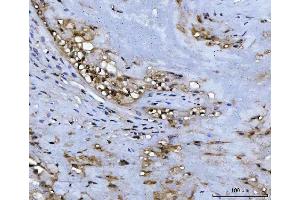 IHC analysis of ADK using anti-ADK antibody (ABIN4886430). (ADK Antikörper  (AA 165-351))