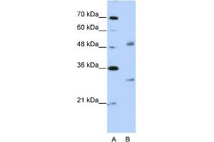 WB Suggested Anti-WBSCR1 Antibody Titration:  2. (EIF4H Antikörper  (Middle Region))