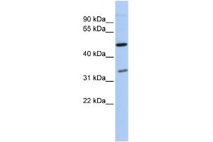 WB Suggested Anti-PQBP1 Antibody Titration:  0. (PQBP1 Antikörper  (Middle Region))