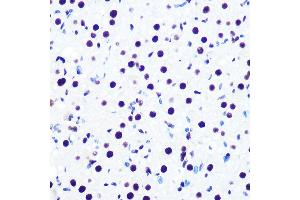 anti-DEAD (Asp-Glu-Ala-Asp) Box Polypeptide 5 (DDX5) antibody