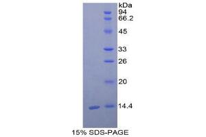 SDS-PAGE (SDS) image for Cystatin C (CST3) (AA 24-139) protein (His tag) (ABIN2120941)