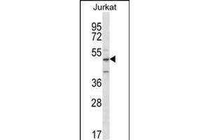 ABI2 Antibody (N-term)  western blot analysis in Jurkat cell line lysates (35 μg/lane). (ABI2 Antikörper  (N-Term))
