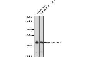Western blot analysis of extracts of various cell lines, using HSP20/HSPB6 Rabbit mAb (ABIN7267592) at 1:1000 dilution.