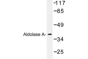 Image no. 1 for anti-Aldolase A, Fructose-Bisphosphate (ALDOA) antibody (ABIN272155) (ALDOA Antikörper)