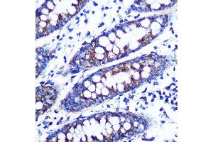 Immunohistochemistry of paraffin-embedded human colon using Monoamine Oxidase B (MAOB) (MAOB) Rabbit mAb (ABIN7268682) at dilution of 1:100 (40x lens). (Monoamine Oxidase B Antikörper)