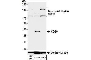 Western Blotting (WB) image for anti-Biotin antibody (ABIN7795748) (Rekombinanter Biotin Antikörper)