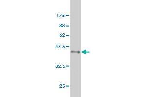 Western Blot detection against Immunogen (36. (Exportin 2 Antikörper  (AA 872-971))