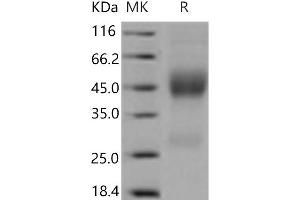 Western Blotting (WB) image for Neurexophilin 1 (NXPH1) protein (His tag) (ABIN7321231) (Neurexophilin 1 Protein (NXPH1) (His tag))