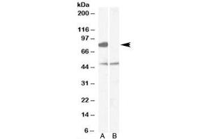 Western blot testing of human brain [frontal cortex] lysate with [B] and without [A] immunizing peptide using ZDHHC8 antibody at 0. (ZDHHC8 Antikörper)
