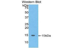 Western Blotting (WB) image for anti-SH2 Domain Containing 1A (SH2D1A) (AA 18-115) antibody (ABIN3202059) (SH2D1A Antikörper  (AA 18-115))