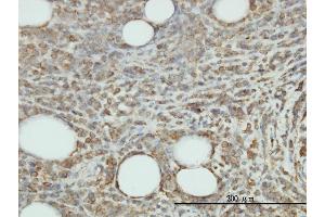 Immunostaining (ISt) image for anti-Junctional Adhesion Molecule 2 (JAM2) (AA 29-298) antibody (ABIN566190)