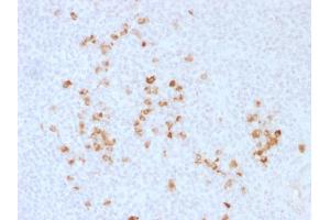 Formalin-fixed, paraffin-embedded human Tonsil stained with Anti-human IgG Rabbit Polyclonal Antibody. (IGHG Antikörper)