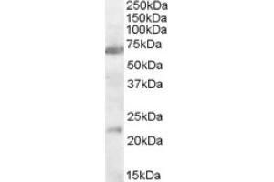 Image no. 1 for anti-Cholinergic Receptor, Nicotinic, alpha 4 (CHRNA4) (AA 29-43), (Internal Region) antibody (ABIN375184) (CHRNA4 Antikörper  (Internal Region))