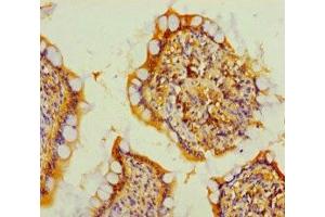 Immunohistochemistry of paraffin-embedded human small intestine tissue using ABIN7173135 at dilution of 1:100 (TMEM27 Antikörper  (AA 73-146))