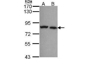 WB Image Sample (30 ug of whole cell lysate) A: A431 , B: H1299 7. (Calpain 5 Antikörper)