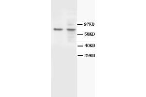 Western Blotting (WB) image for anti-BRCA1 Associated Protein-1 (Ubiquitin Carboxy-terminal Hydrolase) (BAP1) antibody (ABIN1105494) (BAP1 Antikörper)