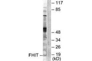 Western blot analysis of extracts from A549 cells, using FHIT Antibody.