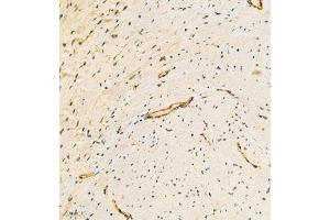 Immunohistochemistry analysis of paraffin embedded mouse heart using ACTN1 (ABIN7072905) at dilution of 1: 300 (ACTN1 Antikörper)