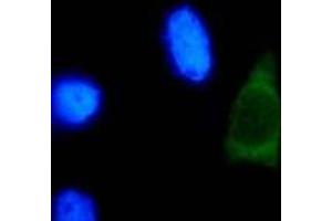 Immunofluorescence (IF) image for anti-Human Papilloma Virus Type 18 (HPV-18) (AA 1-83), (N-Term) antibody (ABIN781773) (HPV18 Antikörper  (N-Term))