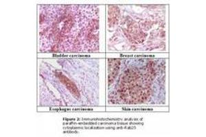 Image no. 1 for anti-RAB25, Member RAS Oncogene Family (RAB25) antibody (ABIN207613) (RAB25 Antikörper)