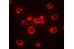 Immunofluorescent analysis of CD288 staining in MCF7 cells. (TLR8 Antikörper)