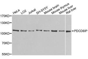 Western blot analysis of extracts of various cell lines, using PDCD6IP antibody. (ALIX Antikörper  (AA 1-180))