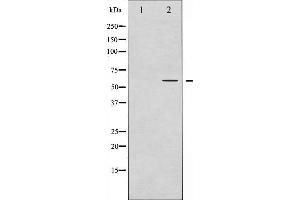 Western blot analysis of IRF-3 phosphorylation expression in Insulin treated HT29 whole cell lysates,The lane on the left is treated with the antigen-specific peptide.