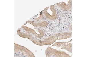 Immunohistochemical staining of human gallbladder with ZNF642 polyclonal antibody  shows moderate membrane and cytoplasmic positivity in glandular cells at 1:200-1:500 dilution. (ZFP69 Antikörper)