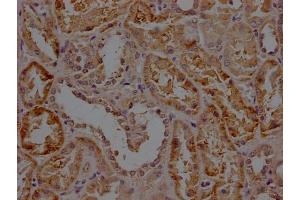 IHC image of ABIN7156171 diluted at 1:200 and staining in paraffin-embedded human kidney tissue performed on a Leica BondTM system. (RHBDF2 Antikörper  (AA 1-200))