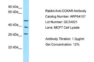 Western Blotting (WB) image for anti-Cholecystokinin A Receptor (CCKAR) (N-Term) antibody (ABIN2789734)