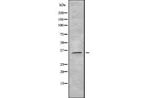 Western blot analysis OR5M3 using HeLa whole cell lysates (OR5M3 Antikörper)