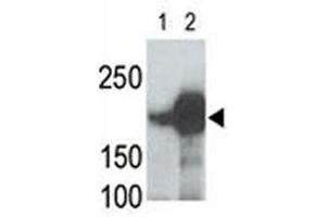 LRP5 antibody used in western blot to detect recombinant human LRP5 (Lane 1) and mouse LRP5 (2) proteins in transfected 293 cell lysate