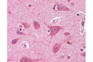 Immunohistochemistry (IHC) image for anti-Brain and Reproductive Organ-Expressed (TNFRSF1A Modulator) (BRE) (AA 9-338) antibody (ABIN604922)
