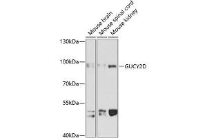 Western blot analysis of extracts of various cell lines, using GUCY2D antibody (ABIN1680144, ABIN3017868, ABIN3017870 and ABIN6220291) at 1:1000 dilution. (GUCY2D Antikörper  (AA 52-350))