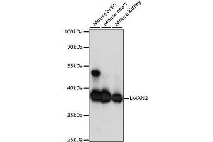 Western blot analysis of extracts of various cell lines, using LM antibody (ABIN7268203) at 1:1000 dilution. (LMAN2 Antikörper  (AA 190-320))