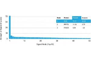 Analysis of Protein Array containing more than 19,000 full-length human proteins using Progesterone Receptor Mouse Monoclonal Antibody (PGR/2694). (Progesterone Receptor Antikörper  (AA 483-571))