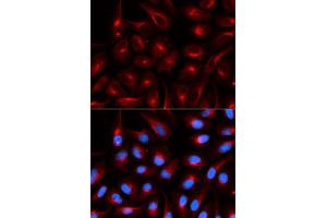 Immunofluorescence analysis of U20S cell using TLE1 antibody. (TLE1 Antikörper)