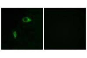 Immunofluorescence analysis of HeLa cells, using Collagen XIV α1 antibody. (COL14A1 Antikörper)