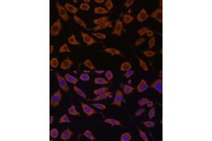 Immunofluorescence analysis of L929 cells using STUB1 Polyclonal Antibody (ABIN6129459, ABIN6148649, ABIN6148650 and ABIN6215447) at dilution of 1:100 (40x lens). (STUB1 Antikörper  (AA 1-303))