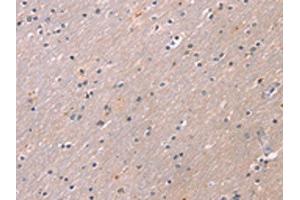 The image on the left is immunohistochemistry of paraffin-embedded Human brain tissue using ABIN7191189(KCNK3 Antibody) at dilution 1/20, on the right is treated with synthetic peptide.