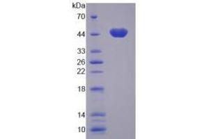 SDS-PAGE (SDS) image for Calcium/calmodulin-Dependent Protein Kinase I (CAMK1) (AA 1-370) protein (His tag) (ABIN6239383)