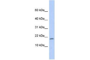 WB Suggested Anti-RPS15 Antibody Titration: 0. (RPS15 Antikörper  (Middle Region))