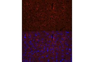 Immunofluorescence analysis of mouse brain using G Rabbit pAb (ABIN3021187, ABIN3021188, ABIN3021189 and ABIN6214056) at dilution of 1:100 (40x lens). (GAD65 Antikörper  (AA 401-585))