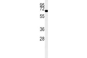 ACOX1 antibody western blot analysis in K562 lysate (15ug/lane). (ACOX1 Antikörper)