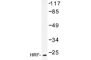 Image no. 1 for anti-Tumor Protein, Translationally-Controlled 1 (TPT1) antibody (ABIN272165) (TPT1 Antikörper)