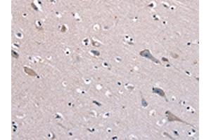 The image on the left is immunohistochemistry of paraffin-embedded Human brain tissue using ABIN7129969(KCNQ5 Antibody) at dilution 1/60, on the right is treated with fusion protein.