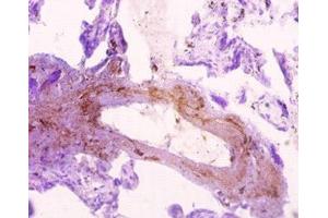 Immunohistochemistry of paraffin-embedded human placenta tissue using ABIN7170369 at dilution of 1:10 (Sorting Nexin 2 Antikörper  (AA 1-102))